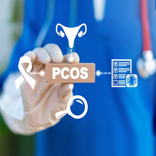 pcos-treatment